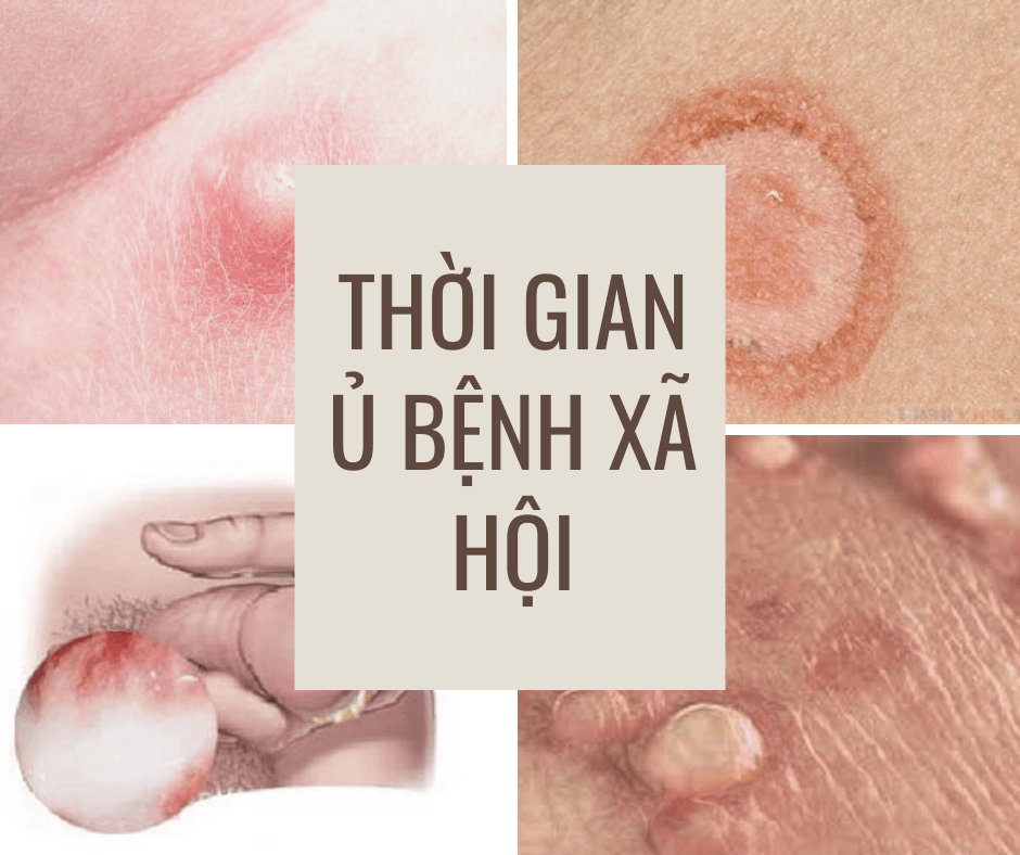 Bệnh xã hội gây ngứa vùng kín Bệnh xã hội gây ngứa vùng kín