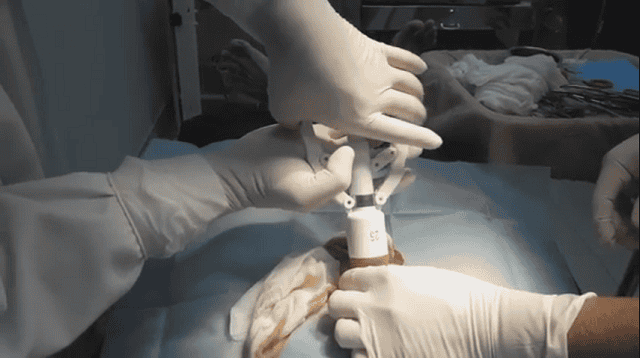 Việc cắt bao quy đầu cần có chỉ định rõ ràng, không phải ai cũng cần thực hiện thủ thuật này Việc cắt bao quy đầu cần có chỉ định rõ ràng, không phải ai cũng cần thực hiện thủ thuật này