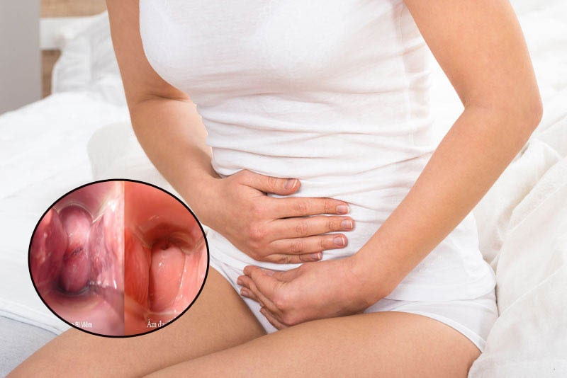 viêm nhiễm âm hộ khiến vùng kín bị ngứa rát và khí hư tiết ra nhiều viêm nhiễm âm hộ khiến vùng kín bị ngứa rát và khí hư tiết ra nhiều