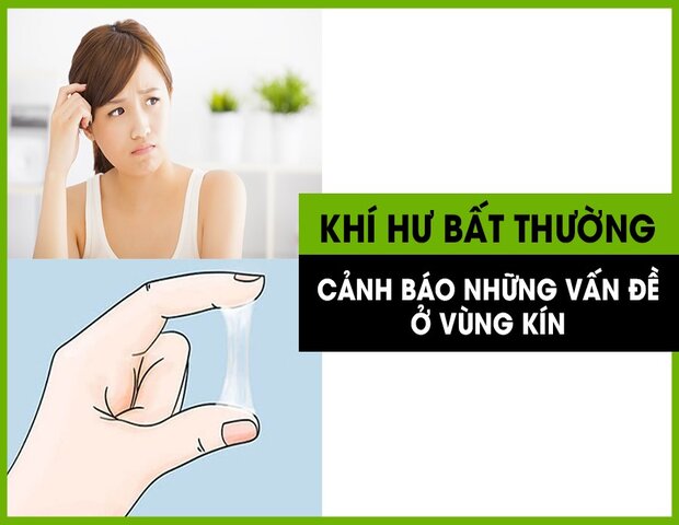 cần điều trị khí hư bất thường vì rất có thể chị em đang mắc bệnh lý phụ khoa cần điều trị khí hư bất thường vì rất có thể chị em đang mắc bệnh lý phụ khoa