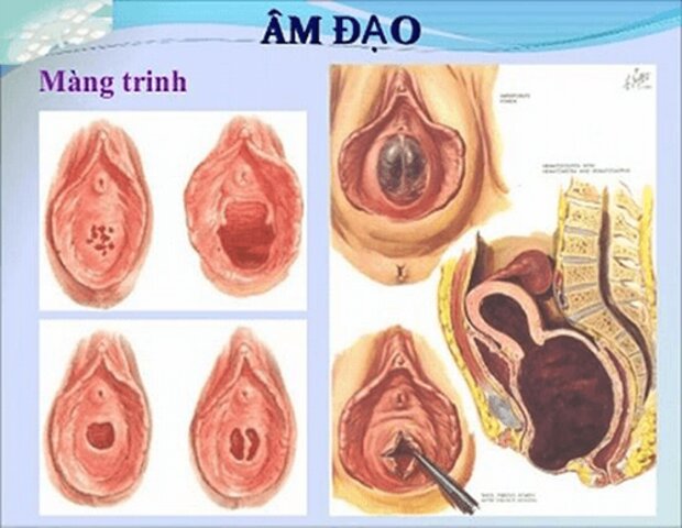 cấu tạo và các dạng màng trinh cấu tạo và các dạng màng trinh