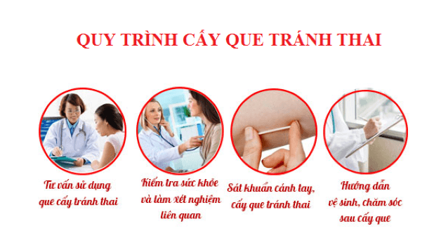 quy trình cấy que tránh thai nên được thực hiện cẩn thận quy trình cấy que tránh thai nên được thực hiện cẩn thận
