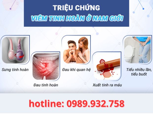 dấu hiệu viêm tinh hoàn dễ nhận biết dấu hiệu viêm tinh hoàn dễ nhận biết