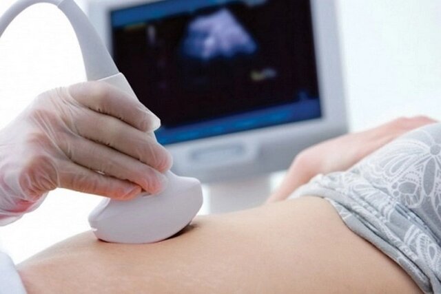 bác sĩ siêu âm xác định chính xác tuổi của thai nhi để lựa chọn phương pháp phá thai an toàn bác sĩ siêu âm xác định chính xác tuổi của thai nhi để lựa chọn phương pháp phá thai an toàn