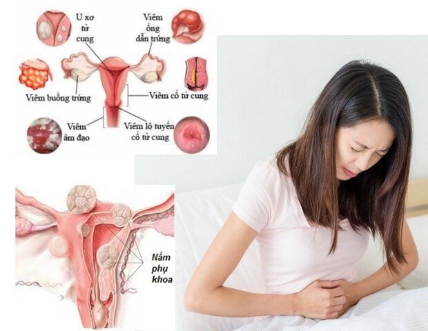 một số căn bệnh phụ khoa chị em thường hay mắc phải một số căn bệnh phụ khoa chị em thường hay mắc phải