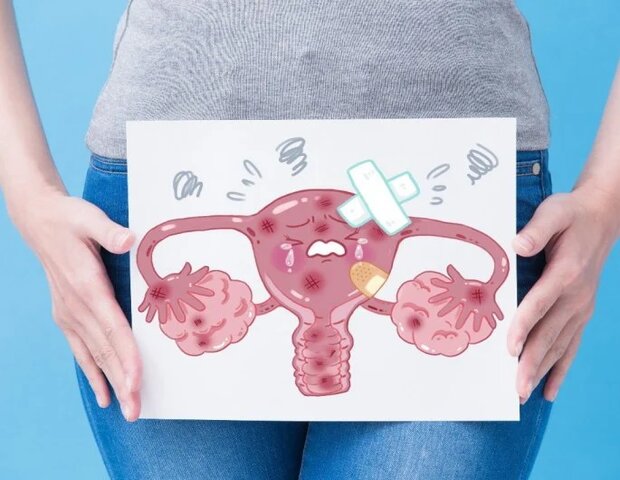 chị em cần tìm cách trị kinh nguyệt không đều sớm nếu liên quan đến bệnh phụ khoa chị em cần tìm cách trị kinh nguyệt không đều sớm nếu liên quan đến bệnh phụ khoa