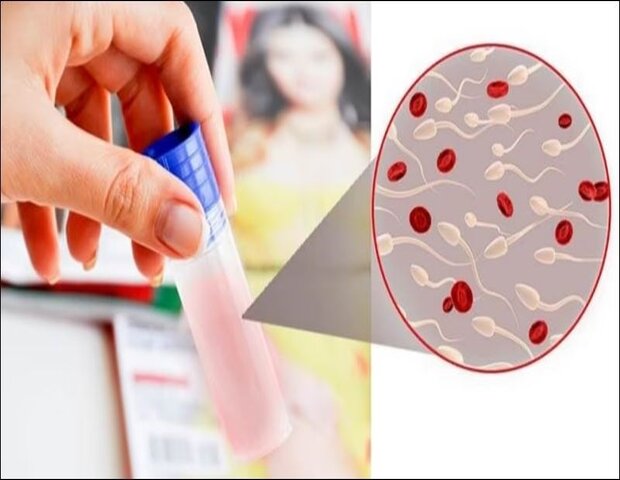 hiện tượng xuất tinh ra máu ở nam giới hiện tượng xuất tinh ra máu ở nam giới