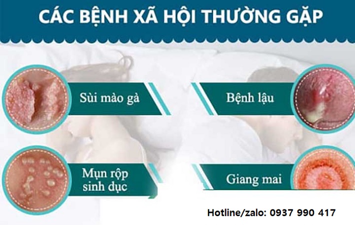 Bị nổi mụn ở vùng kín có nguy hiểm không