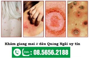 khám bệnh giang mai ở quảng ngãi