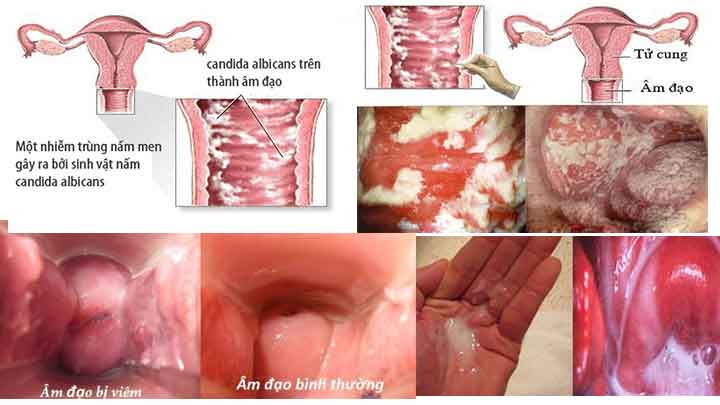 khám viêm âm đạo ở đâu Bách Lạc