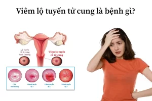 Khám viêm lộ tuyến cổ tử cung ở đâu Bách Lạc