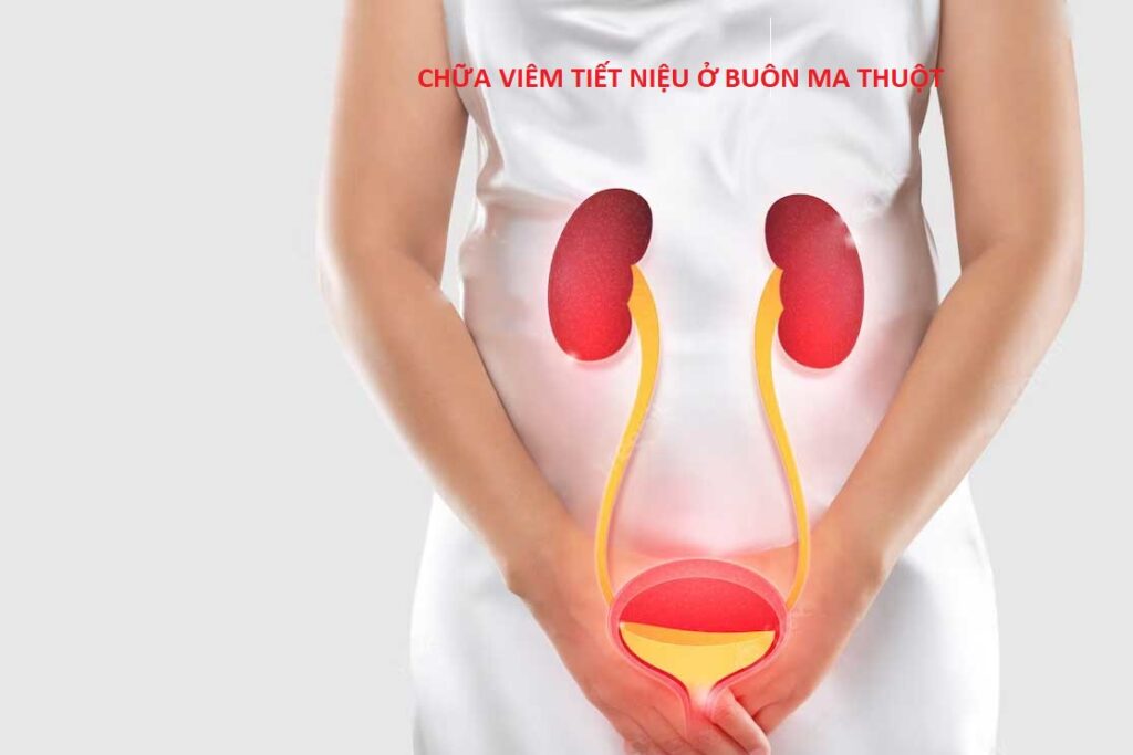 Tiểu buốt khám ở đâu Buôn Ma Thuột